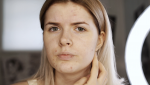 National Acne Awareness Month: Ending Acne Censorship on Social Media