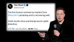 Elon Musk announces first implanted “brain chip” from company Neuralink 