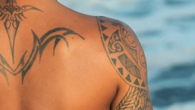 Remove Tattoos and Unwanted Skin Marks